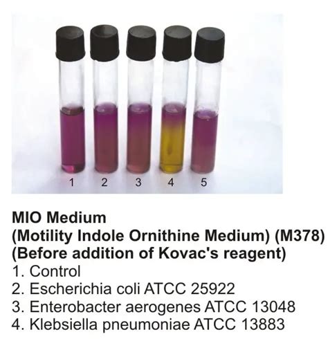 motility test are conducted with soft gel media|motility testing medium protocol.